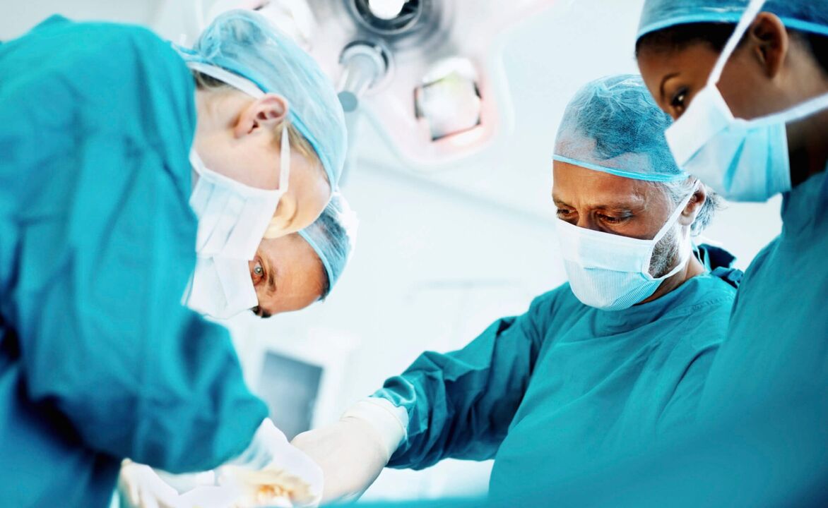 Der Prozess der Penisvergrößerung durch Chirurgen durch eine Operation. 